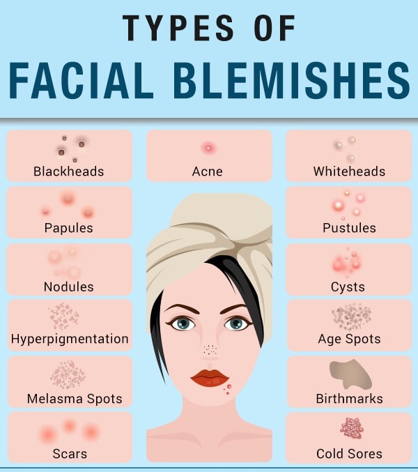 blemishes-types