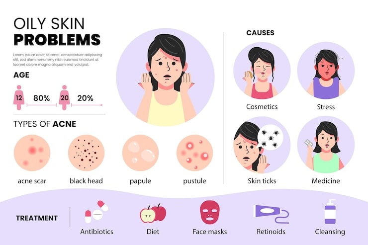 prevention-of-acne