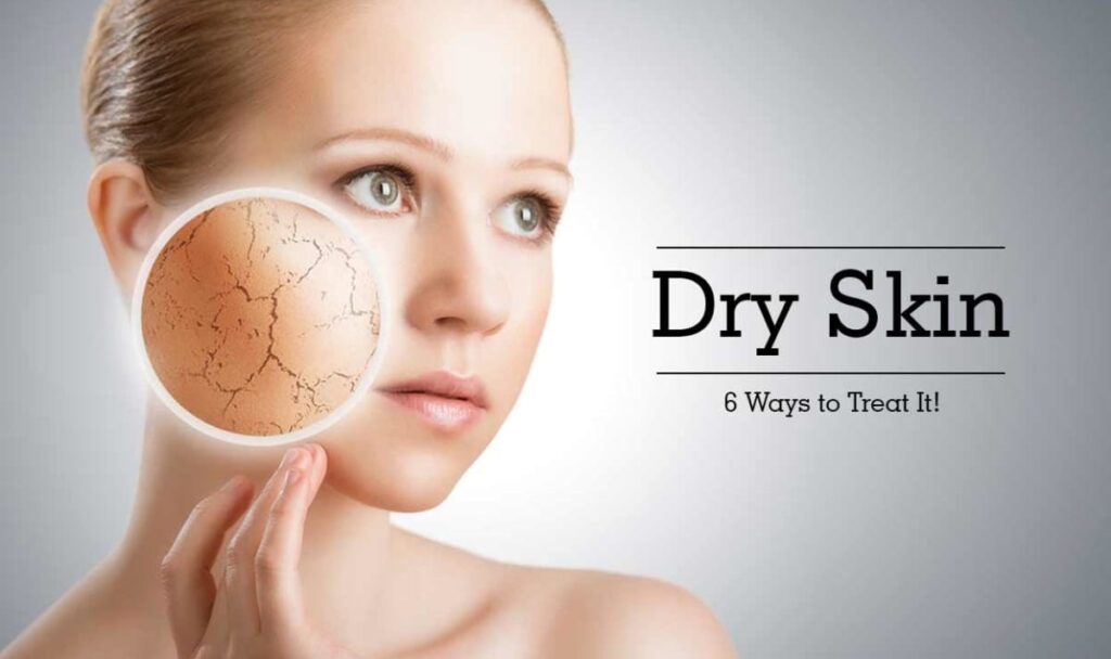 Dry Skin SOS: Understanding the Causes and Symptoms - Products review ...