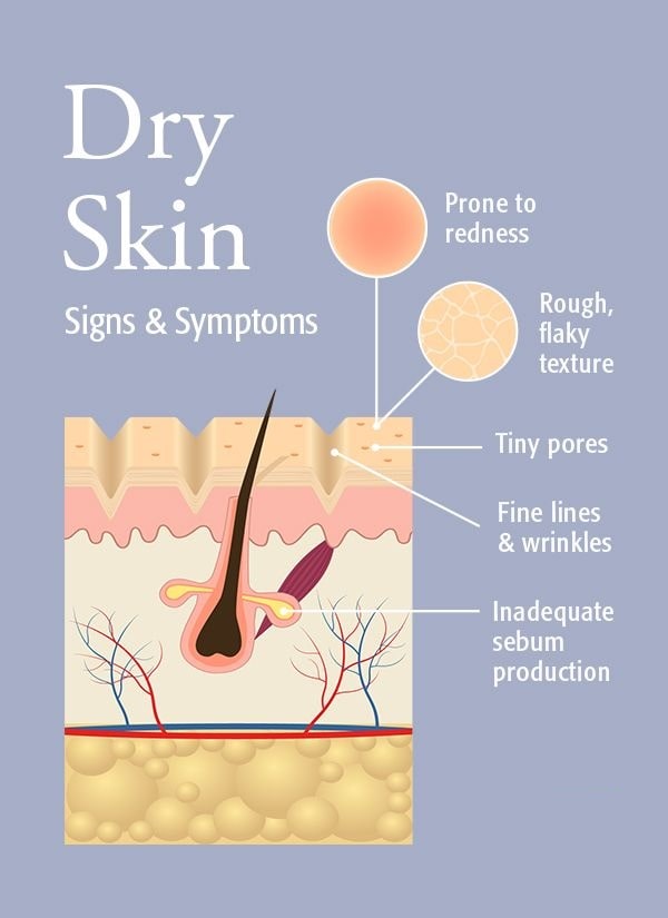 symptoms-of-dry-skin