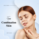 Combination Skin: Understanding Your Skin Type and How to Care for It