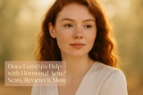 Does LumiSpa Help with Hormonal Acne? Scars, Reviews & More