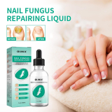 Kerassentials Oil Nail Fungus Treatment: Does It Really Work? | Expert Reviews