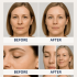 How Long Does Lumispa Take to Reduce Wrinkles?
